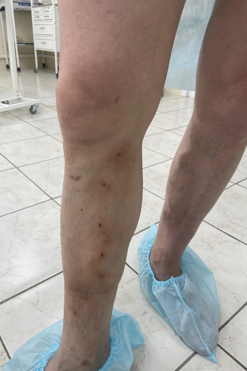 1 месяц после